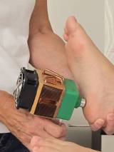 Kryo-Kaelteanwendung-bei-Entzuendungen