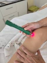 Laser-Anwendung-bei-Sehnenschmerzen